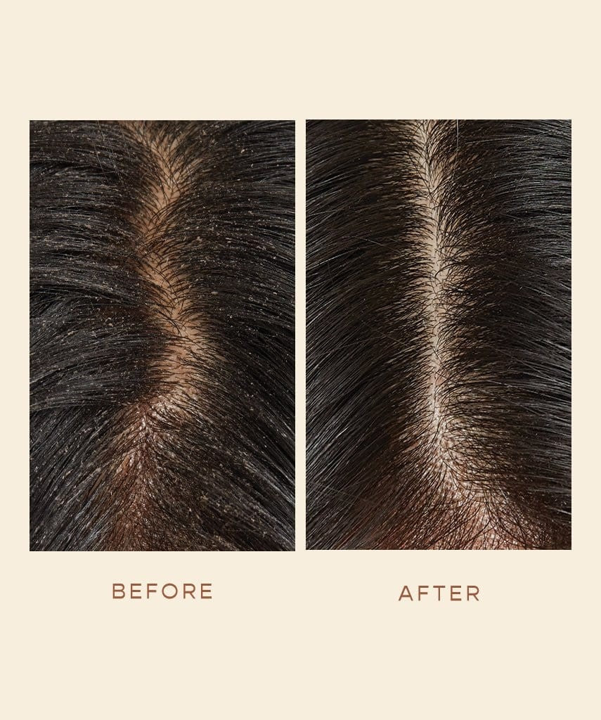 Hair Oil (Well Rooted Well Grow) Subees Organic